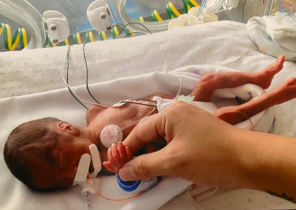 Premature baby in an incubator. 